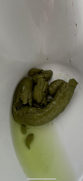3 year olds poops
