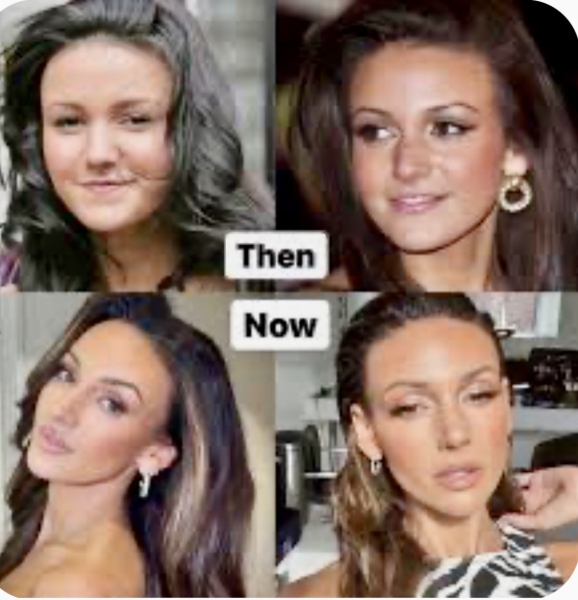 To think Michelle Keegan has incredible genes