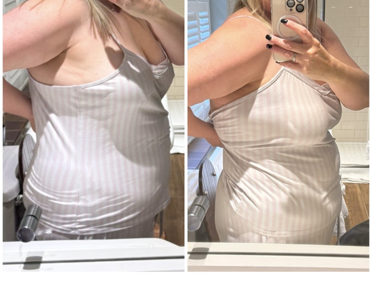 Mounjaro / Wegovy with > 5st / 30kg to lose: Thread 6