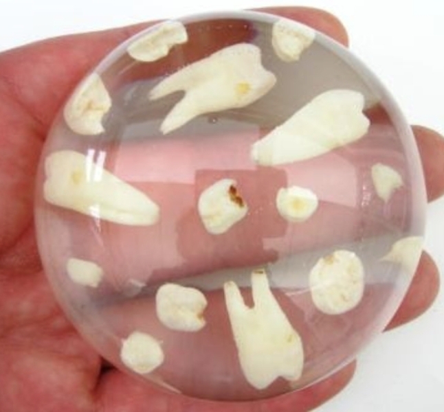 WIBU to keep teeth?