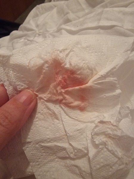 Spotting light red pinkish ! Help!