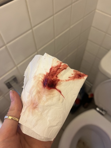 IVF- would you class this as my 1st day of my period?