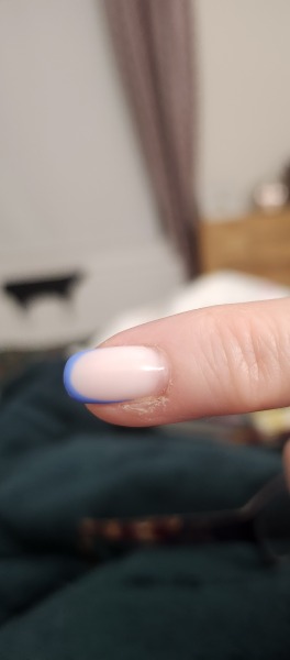 Is this a little wart or something else growing?