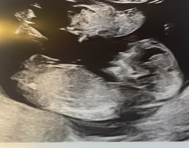 Nub? Is there no nub? Anyone got any guesses