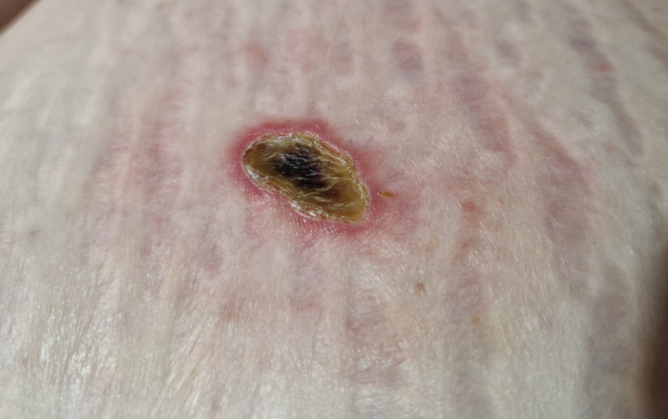 Random raw skin thing - ideas?