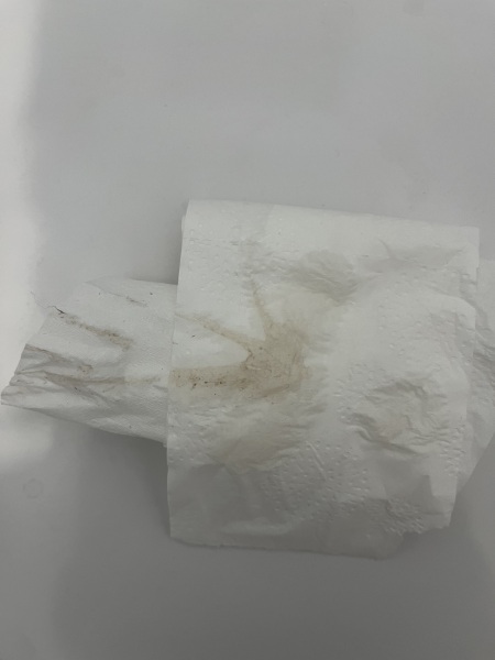 Weird spotting but no period - pregnant or miscarriage?