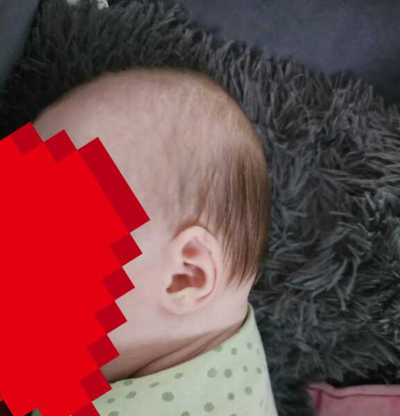 Baby flat head or normal?