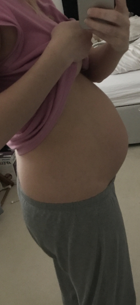 Anxious about my bump size 🫣