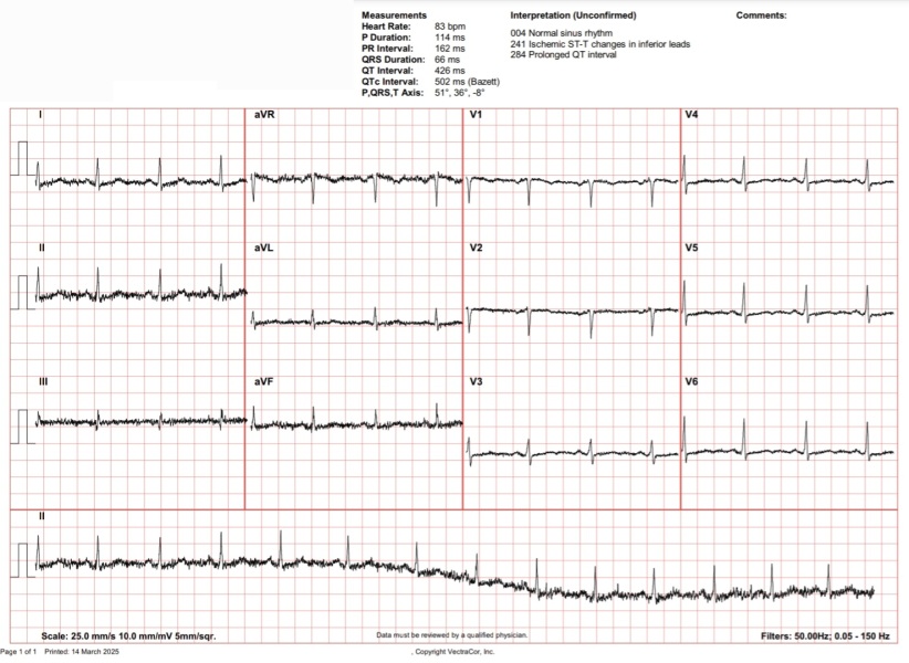Panicking over ecg