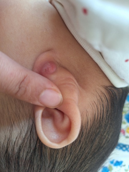 HELP! I’ve messed with my daughters ear piercing and can’t get the earring back in!