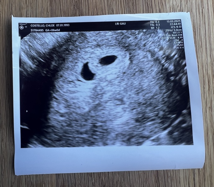 Extremely worried..help!