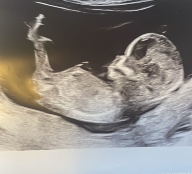 Nub? Is there no nub? Anyone got any guesses