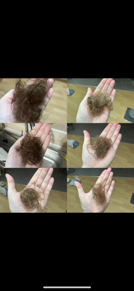 To think this is a lot of hair loss in shower?