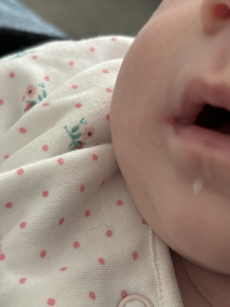 Does this look like a cold sore?