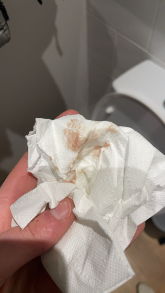 Is this implantation bleeding?