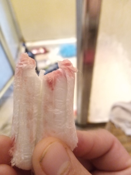 Am I having a miscarriage or is this spotting?