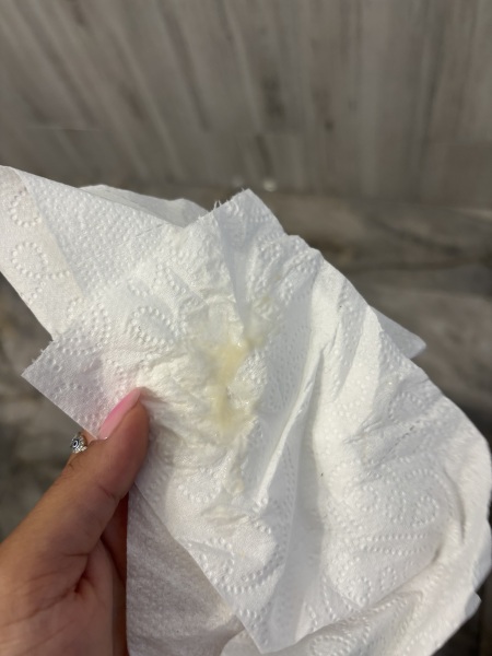 Is this early discharge in pregnancy