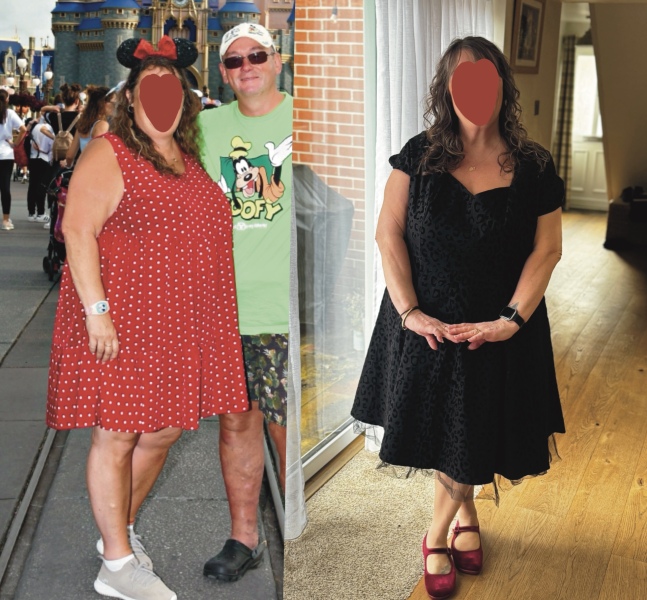 Mounjaro, 10st or more to lose, thread two