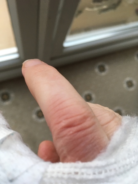 Mystery - Thumb went black
