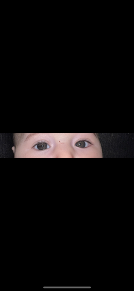 4 months old baby eye spot and colour