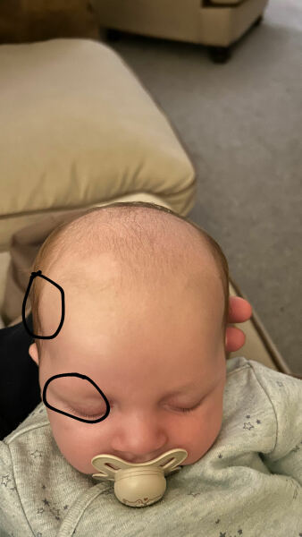 8 week old bumpy head