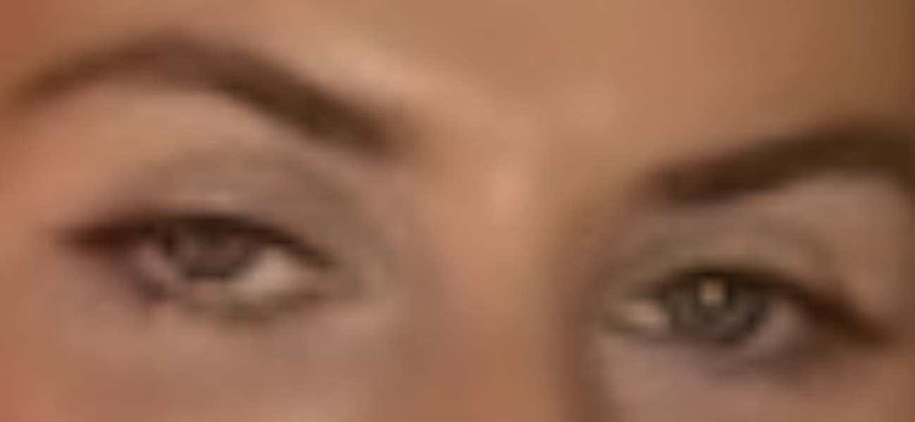 Lazy eye lid