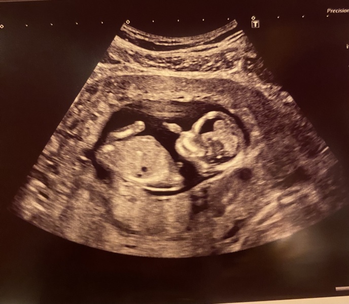Gender guesses? just a bit of fun!✨