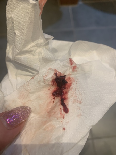 *GRAPHIC* Is this a miscarriage?