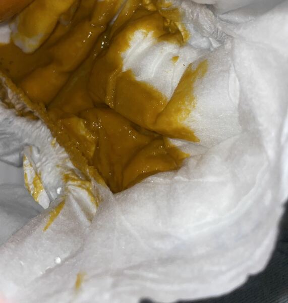 5 week old - diarrhoea frothy poo? Photo warning