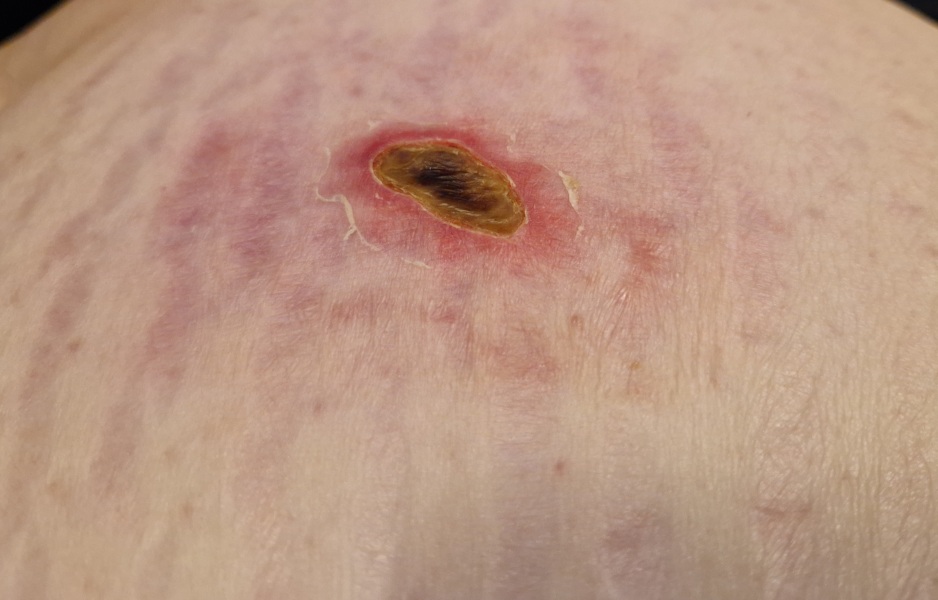 Random raw skin thing - ideas?