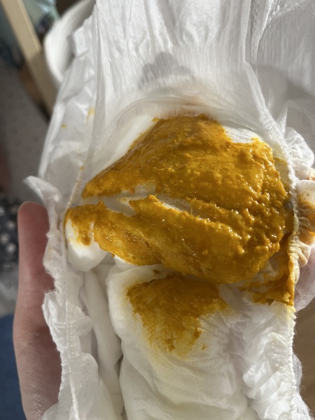 Baby poo - advice! CMPA?