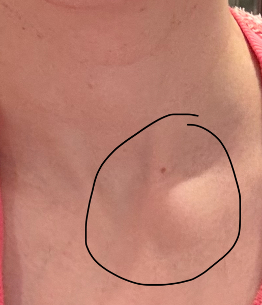 Unsure if I have a lump or not?