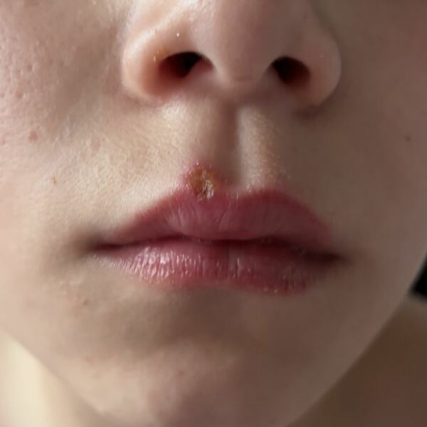 How accurate was the pharmacist, do you think?