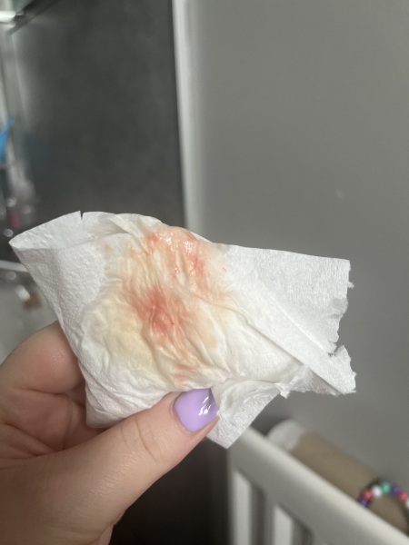 Bleeding at 6 weeks
