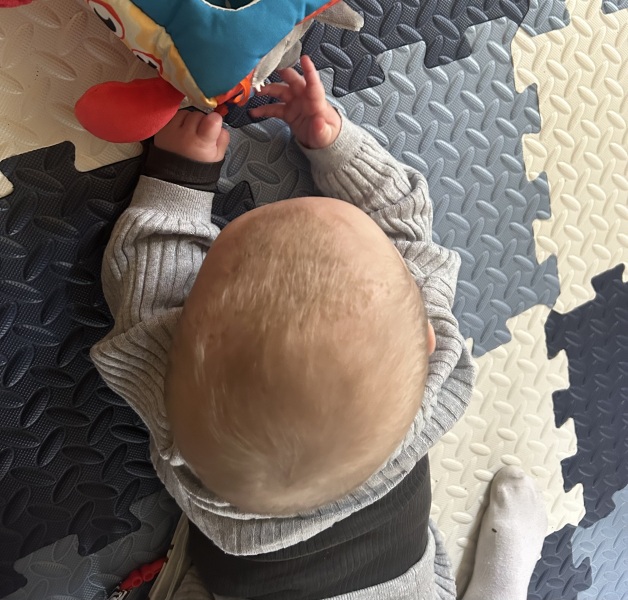 Worried about 6 month old son’s head shape -