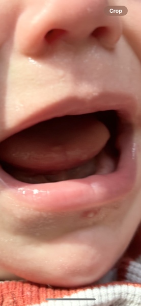 Scabby/ weeping behind ear