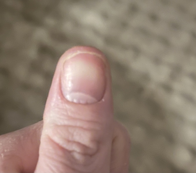 What is this on my nail?? Pic included