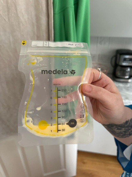 A lot of colostrum at 37 weeks? Photo