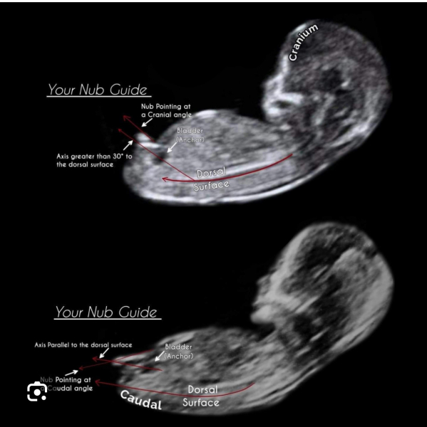 14 weeks boy or girl?