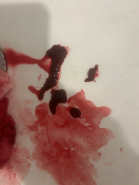 TW does this look like a miscarriage