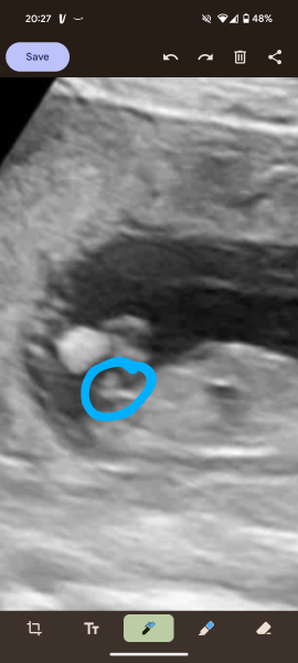 14 weeks boy or girl?