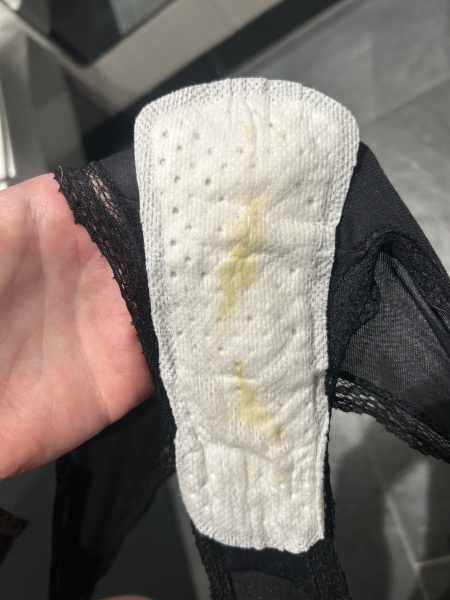 Yellow discharge 34 weeks