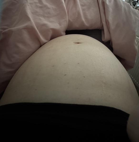 10dpo does anybody see it? X