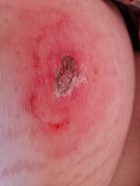 Random raw skin thing - ideas?