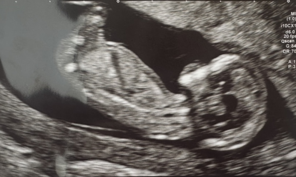 GENDER PREDICTIONS💖💙