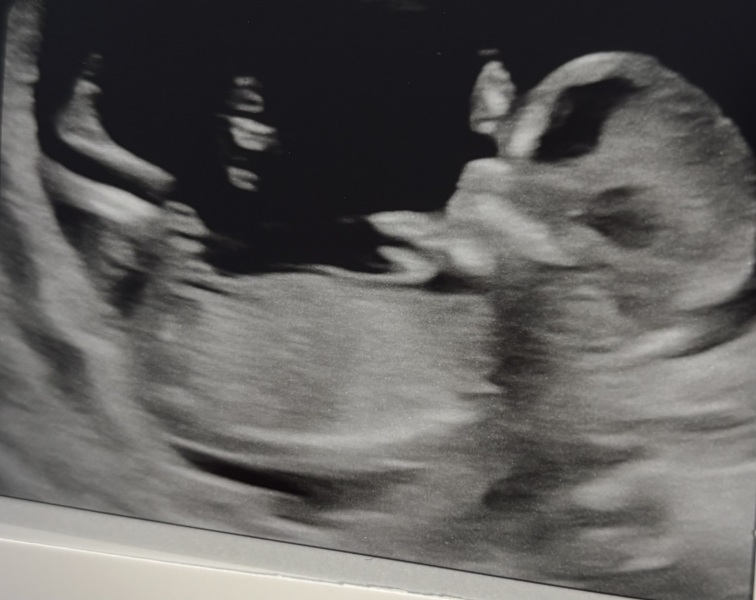 Any gender guesses?
