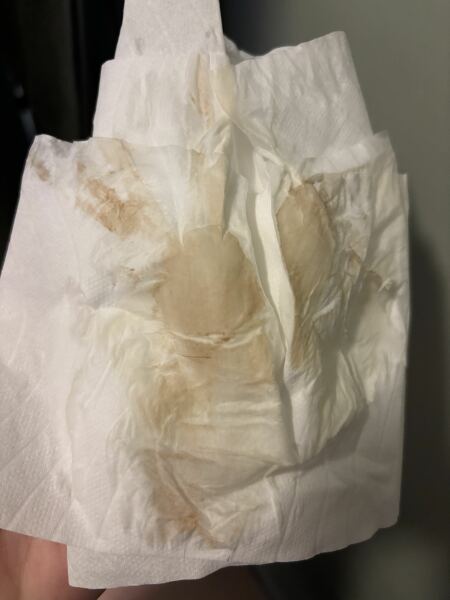 Ftm brown when I wipe 8 weeks