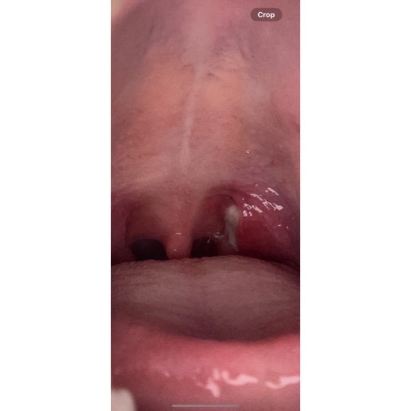 What is this illness?? Anyone else had this?