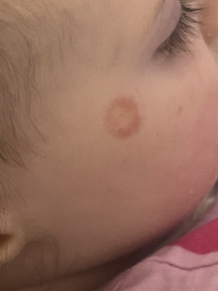 16mo Human coronavirus & norovirus