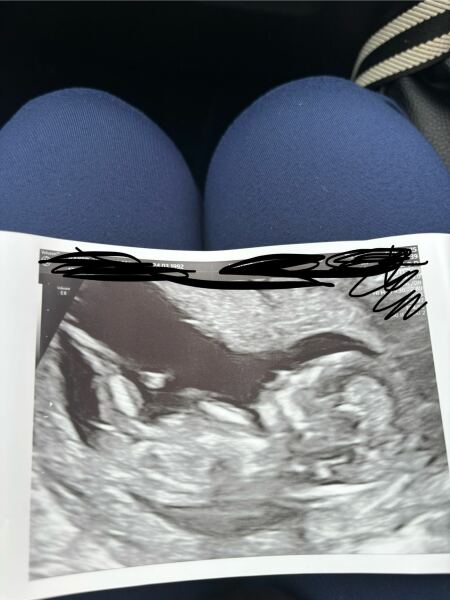 Gender guesses please